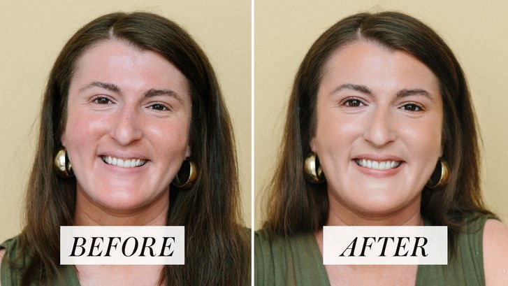 vor und nach Fotos von Make-up für Rötungen Routine