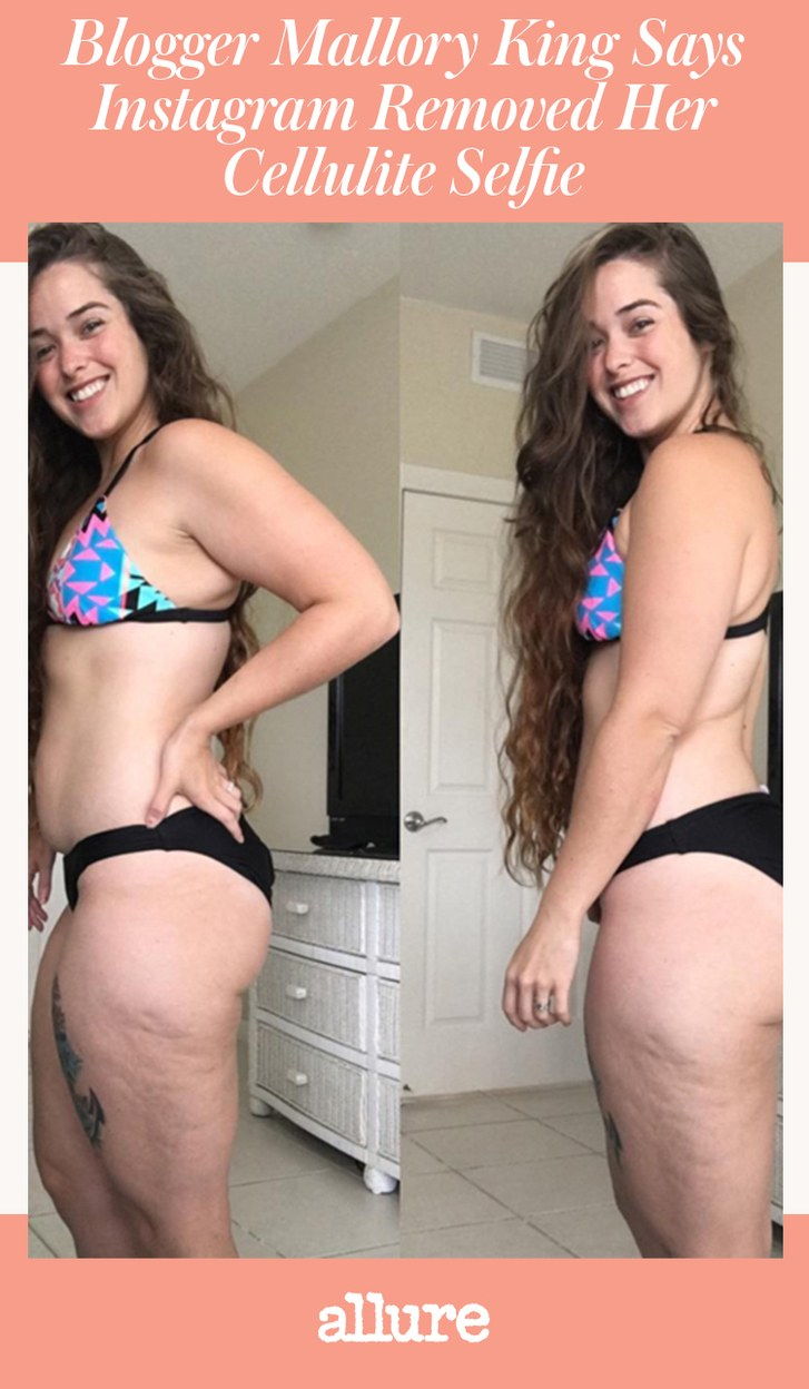 Fitness Blogger Mallory King sagt Instagram entfernt ihre stolze Cellulite Selfie