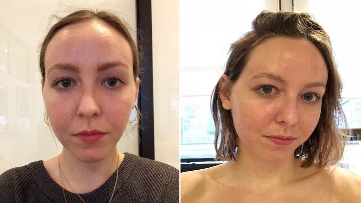 Lákat editor Sarah Kinonen before and after Joanna Vargas facial photos